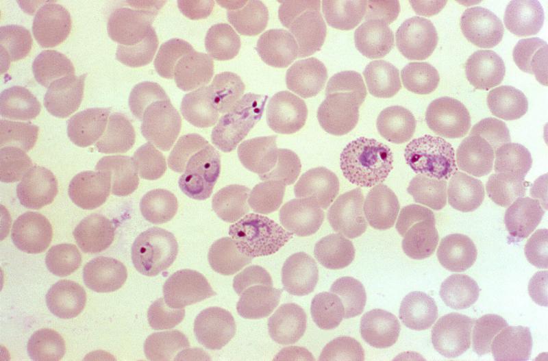 Featured image of post Malaria Unmasked